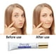 thumbnail image 4 of Pro. W Crema Antimanchas 30g Crema Facial Oil Control para, 4 of 5