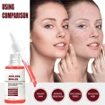 thumbnail image 5 of Suero Facial para reducir los poros, repara los poros grandes, ácido salicílico, antiarrugas, Control de aceite, blanqueamiento, cuidado de la piel, 5 of 5