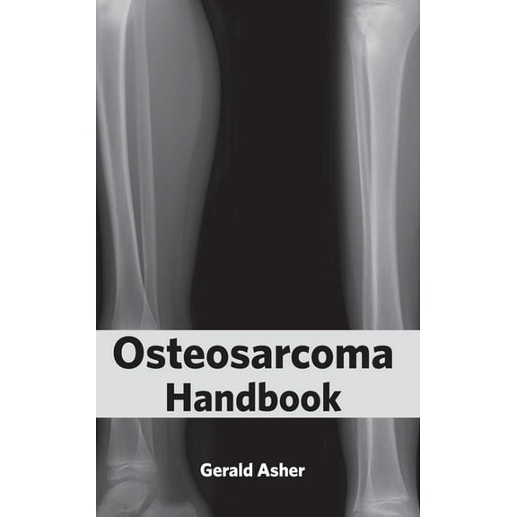 Osteosarcoma Handbook, (Hardcover)
