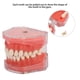thumbnail image 5 of Modelo de encía ANGGREK Dientes removibles, 5 of 8