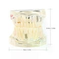 thumbnail image 3 of Dental Models Repairable Resin Models Of Diseased Teeth For Teaching And Research In Medicine And Dental Diseases, 3 of 4