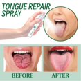 thumbnail image 3 of El spray reparador de lengua Yosoo 30 ml reduce la hinchazón y el mal aliento, 3 of 9