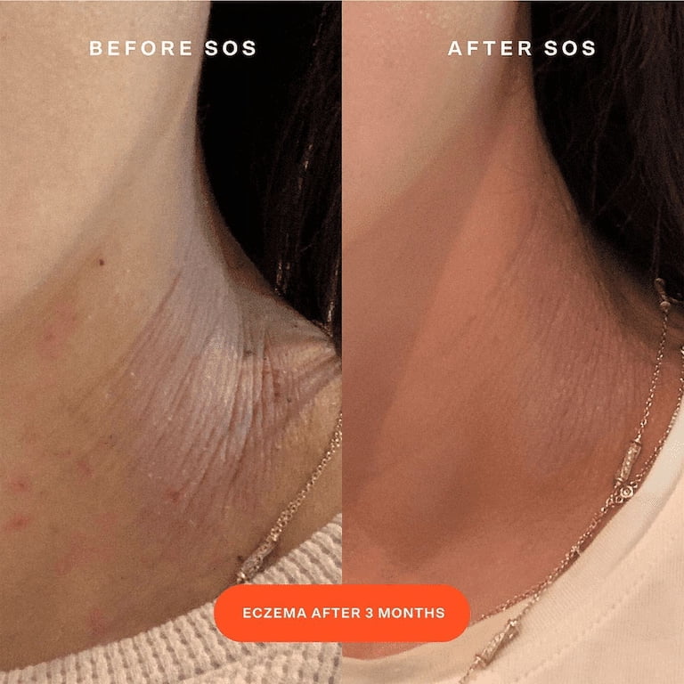 Tower 28 Beauty SOS Daily Rescue Facial Spray with Hypochlorous Acid  1 oz/ 30 mL