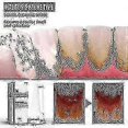 thumbnail image 4 of Jaysuing Tartar Dissolving Mouth Spray Tartar Removes Bad Breath And Tartar, 4 of 5