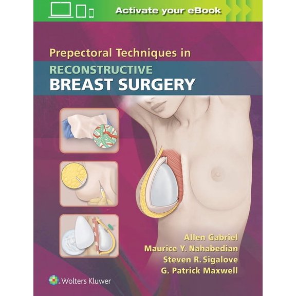 Prepectoral Techniques in Reconstructive Breast Surgery (Hardcover)