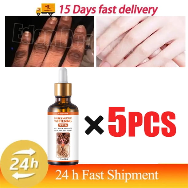 Suero blanqueador rápido para nudillos oscuros, Corrector de melanina para nudillos de manos y codos, productos para el cuidado de la belleza, 50ml