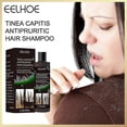 thumbnail image 2 of Nuevo champú anticaspa 2023 para el tratamiento de la picazón, aceite de control, champú limpiador refrescante anticaída, champú para el cuero cabelludo descamado, psoriasis capilar Changzhao | 65, 2 of 5
