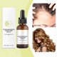 thumbnail image 4 of Fiudx Aceite para El Cuero Cabelludo, Fórmula Nutritiva y Reparadora, Tratamiento Hidratante de 30 Ml, Solución para El Control Del Frizz, Cuidado Capilar Diario, Ingredientes Naturales, Seguro para, 4 of 6