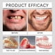 thumbnail image 5 of Juego de prótesis dentales premium, juego de prótesis dentales con revestimiento de silicona avanzado, carillas dentales cosméticas para una sonrisa perfecta., 5 of 5