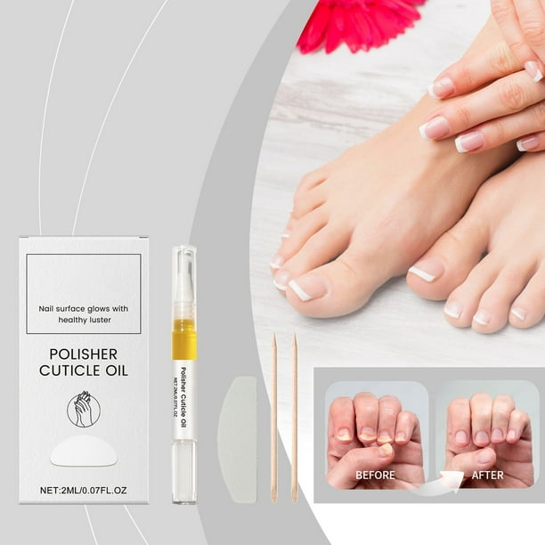 Fiudx Set de Cuidado de Uñas, Líquido Endurecedor Fortalecedor, Hidratante Nutritivo para Cutículas, Tratamiento Fortificante para El Lecho Ungueal, Cuidado Diario de Uñas, Rutina de Belleza para Adu