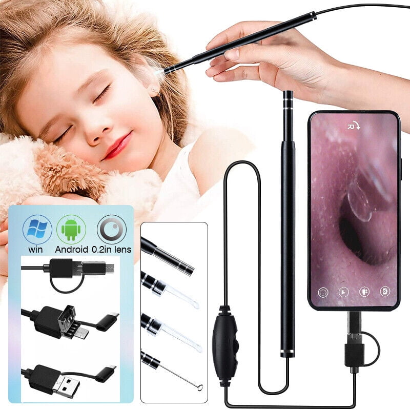ear wax picker with camera