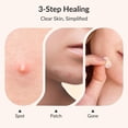 thumbnail image 3 of Pimple Patch RPE Life, hidrocoloide de ácido salicílico, 72 unidades, 3 of 7