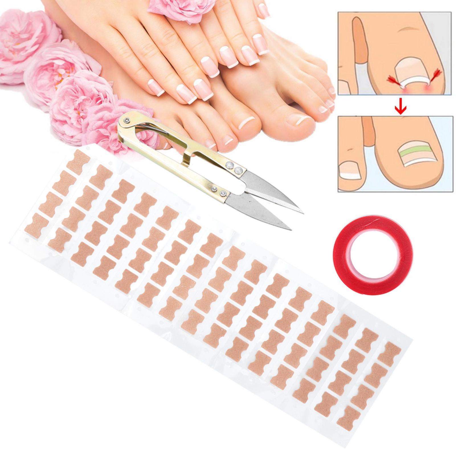 Tebru Ingrown Nail Correction Sticker,DoubleSided Tape Toenail