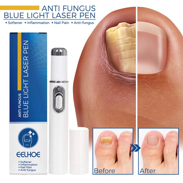 Hot Nail FLhrweasw Fungal Pen Removal Serum Gel Productos de Reparación de Pies