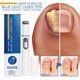 thumbnail image 1 of Hot Nail FLhrweasw Fungal Pen Removal Serum Gel Productos de Reparación de Pies, 1 of 9