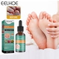 thumbnail image 1 of Solución Reparadora De Uñas Grises Solución De Reparación De Uñas Gris 30Ml Esencia De Eliminación De Hongos En Las Uñas Cuidado De La Reparación Del Cuidado De Los Pies Ndcxsfigh Cuidado Belleza, 1 of 4