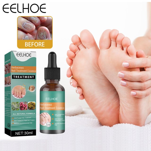 Solución Reparadora De Uñas Grises Solución De Reparación De Uñas Gris 30Ml Esencia De Eliminación De Hongos En Las Uñas Cuidado De La Reparación Del Cuidado De Los Pies Ndcxsfigh Cuidado Belleza