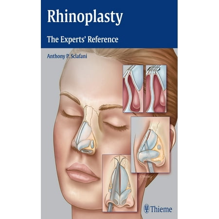 UPC: 9781604068672 | Rhinoplasty: The Experts  Reference (Hardcover)