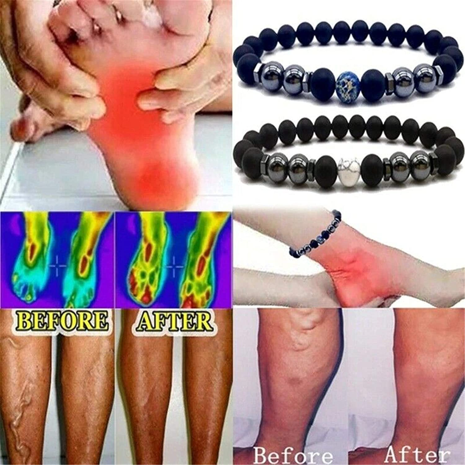 Anti-Swelling Black Obsidian Anklet 