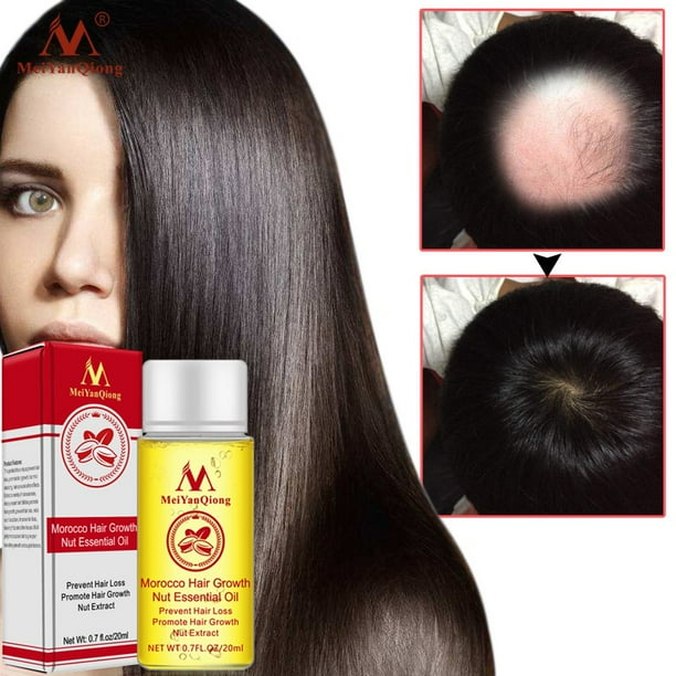 Black Friday Clearance Nut Essential Oil For Hair Growth Organic With Black Seed Oil Hair