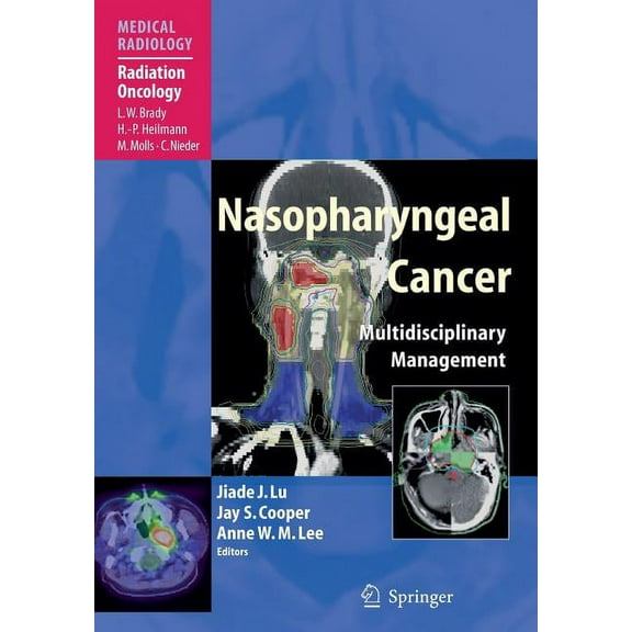 Nasopharyngeal Cancer: Multidisciplinary Management, (Hardcover)