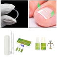 thumbnail image 2 of de herramientas para el de los pies para pedicura, correcci de as encarnadas, parches el?s para as Sunnimix corrector de uñas encarnadas, 2 of 8