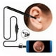 thumbnail image 5 of Otoscopio USB, cámara de otoscopio digital Ultra Ear Scope Otoscopio Otoscopio digital Probado y confiable, 5 of 8