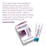 Mederma Advanced Scar Gel (50 g)