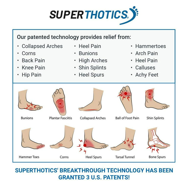Foot, knee, hip, or back pain? Customized arch support can help