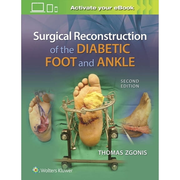 Surgical Reconstruction of the Diabetic Foot and Ankle (Hardcover)