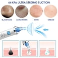 thumbnail image 4 of Jumpingount Pluma de eliminación de espinillas 5 engranajes Instrumentos de eliminación de cuidado de belleza ajustables Cuerpo del baño Jumpingount CE013497-00B, 4 of 6