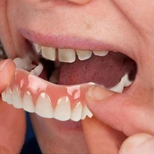 Extra Thin Fake Bright White Tooth Veneers Silicone Soft Safe Adhesive Denture Hide Shade Braces Comfortable Teeth Orthodontic-hy--