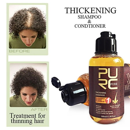 Ginger Scalp Care Shampoo Strengthen Hair Nourish And Repair Hair Tips  100ml | Walmart Canada