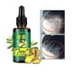 thumbnail image 1 of Aceite germinal de jengibre, aceite para el crecimiento del cabello, suero para el crecimiento del cabello, tratamiento para la pérdida de cabello, cuidado del cabello, suero para el crecimiento del cabello, promueve el crecimiento del cabello más grueso-2PCS- Sincero Electrónica, 1 of 5