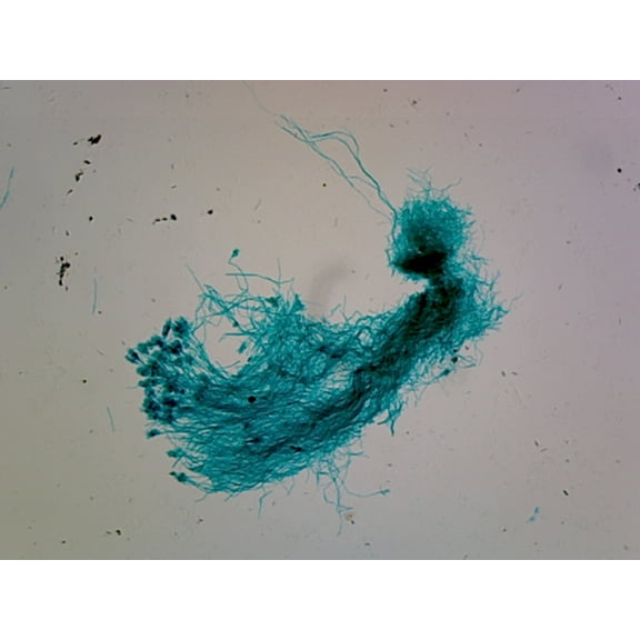 Penicillium; Section Showing Conidiophores with Conidia by Go Science Crazy