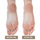 thumbnail image 2 of Máquina Eléctrica Pedicura Exfoliante Removedora Callos para Hombres Y Mujeres (oro Rosa UE), 2 of 3