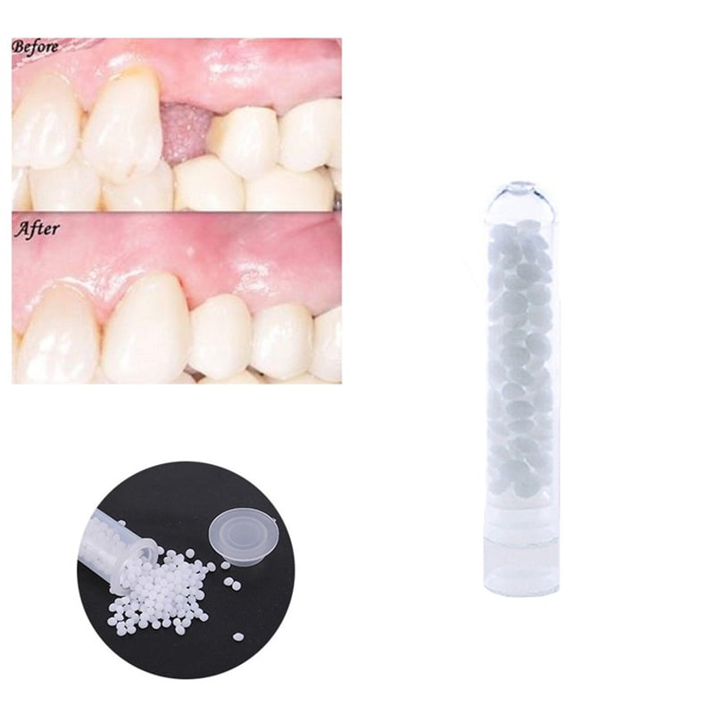 Temporary Tooth Filling Material Missing Teeth Repair Dental Tool Temporary Teeth Filling Material Walmart Canada