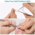 thumbnail image 4 of Cuticle nippers cuticle ..., 4 of 5