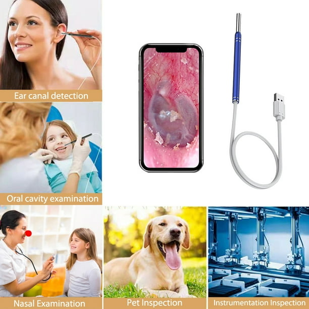 Limpieza de cera para los oídos Otoscopio Palillos para los oídos Cámara Endoscopio 3,9 mm Azul Ndcxsfigh Libre de BPA
