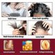 thumbnail image 3 of EELHOE for Women, Hair Growth & Prevents further Hair Loss, Scalp Foam -3118284569315, 3 of 3