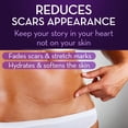 thumbnail image 2 of Scar Gel Cicatricure Advanced 28g for Face & Body, 2 of 8