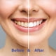 thumbnail image 5 of Tabletas dentales Chomp de canela super blanqueadoras con NHAP, 5 of 9