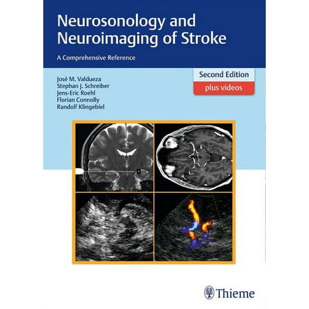 UPC: 9783131418722 | Neurosonology and Neuroimaging of Stroke: A Comprehensive Reference (Hardcover)