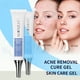 thumbnail image 2 of Buy 2 Get 3 Soft Freckle Extract Acne Removal Marks Facial 20g, 2 of 9