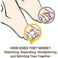 thumbnail image 6 of Welnove 6Pcs Hammer Toe Straightener Splints Cushioned Toe Wraps Cushioned Bandages Correct Bent Curled Overlapping Toes ,Beige, 6 of 7