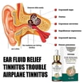thumbnail image 4 of SOUTH MOON 20ml Ear Ringing Relieving Ear Drops Tinnitus Deafness Ear Swelling Ear Discharge Otitis Media Ea, 4 of 5