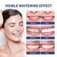 thumbnail image 3 of Best Seller Tooth Paint, Instant Teeth Whitening Paint Extra White Tooth Polish Gel, 3 of 5