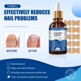 thumbnail image 4 of Solución suavizante YYNRHJ para uñas encarnadas, 30 ml, 4 of 6