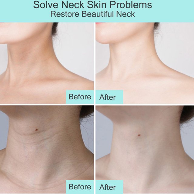 Crema reafirmante para el cuello Crema antiarrugas Crema para el cuello Reafirmante Antienvejecimiento Eliminación de arrugas Crema de masaje tensora Crema hidratante para cuello ANGGREK Otros