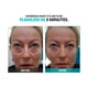 thumbnail image 4 of Crema de estiramiento facial Instantly Ageless Antienvejecimiento, 5 frascos, 4 of 6